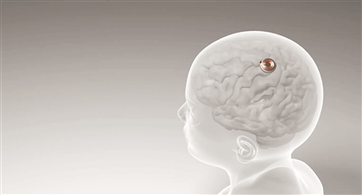 新博2平台：首例脑机接口设备人体移植完成